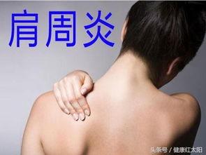 吃瓜会肩膀疼痛吗,小心肩膀疼痛找上门